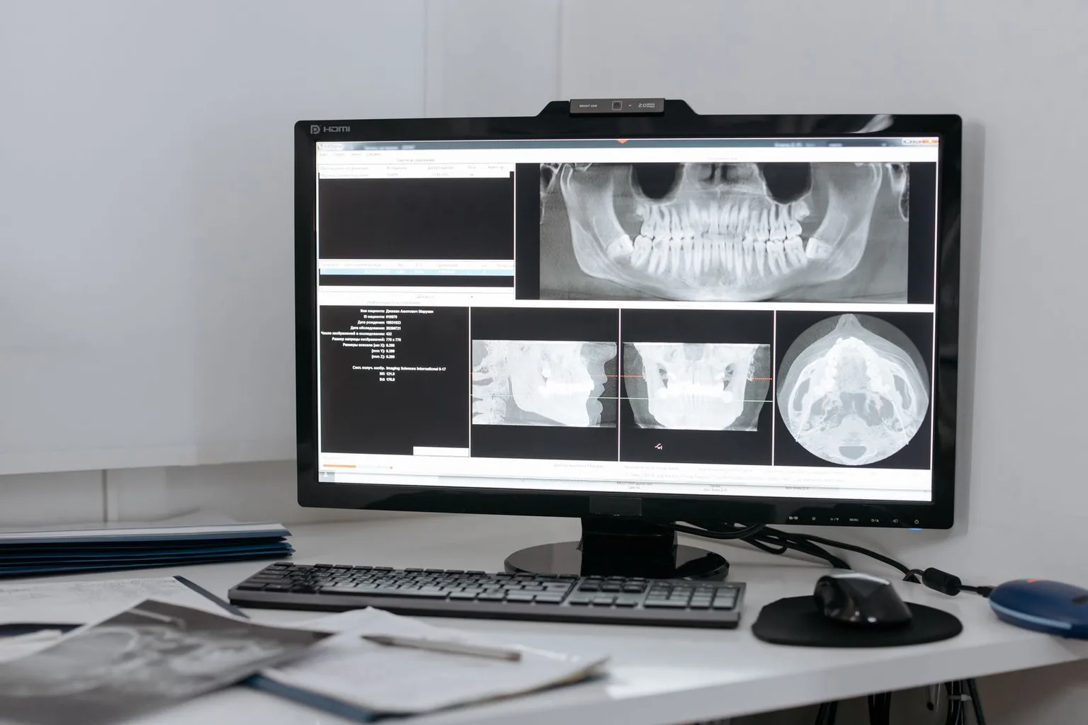Monitor con una radiografía panorámica dental sobre la mesa de trabajo de una clínica