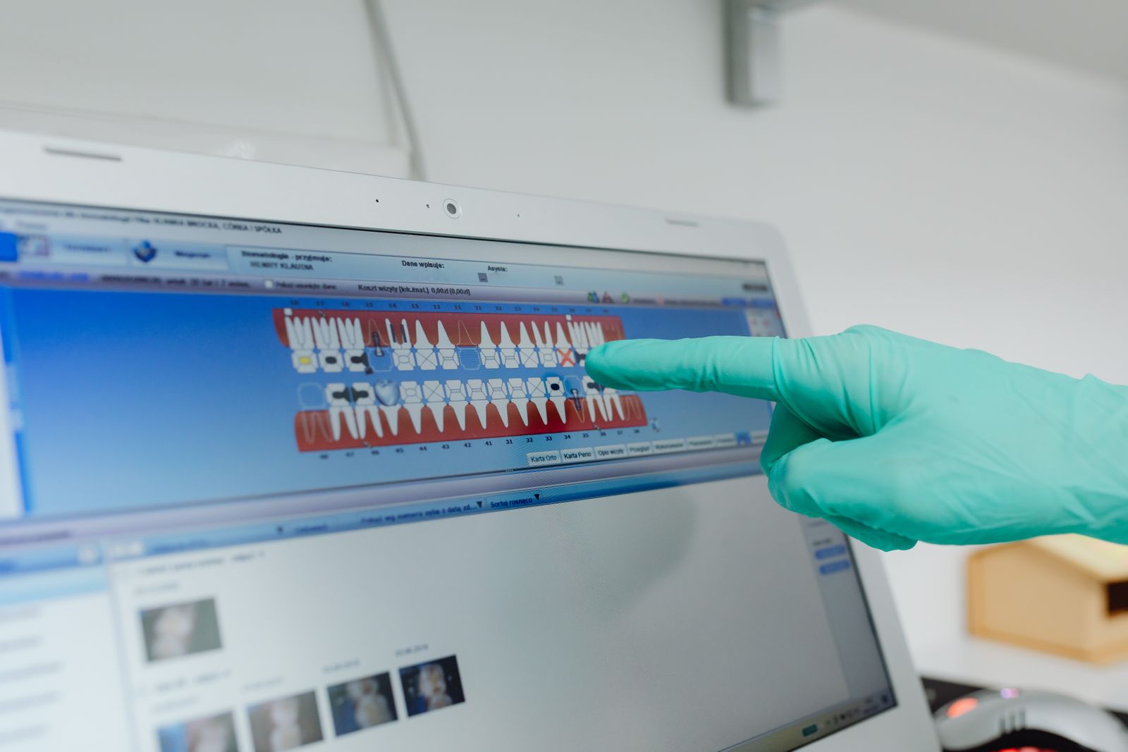 Odontograma digital consultado en pantalla en una clínica dental