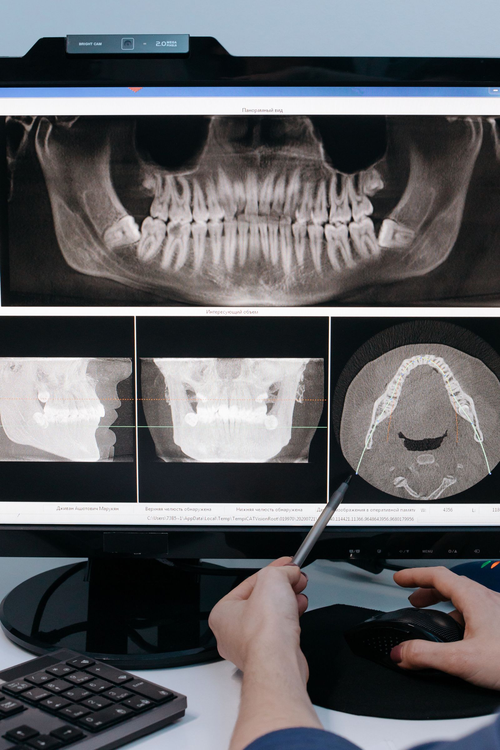 Radiografía panorámica dental consultada en el ordenador de la clínica