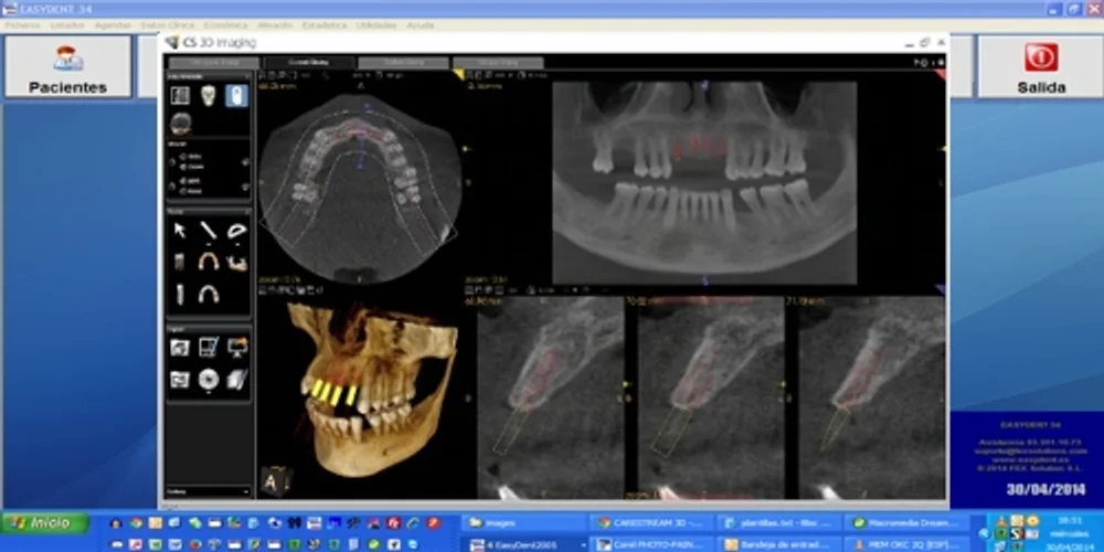 Interfaz usuario EASYDENT programa dental